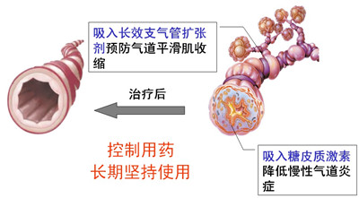 哮喘气道炎症中的抗炎新机制