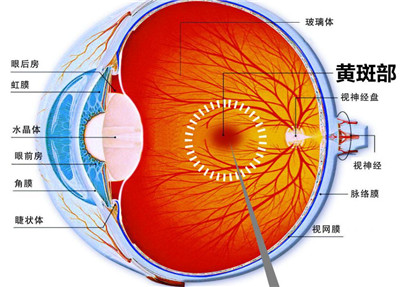 老年黄斑变性