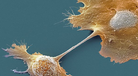 美科学家首次识别出与胰腺癌有关的癌干细胞